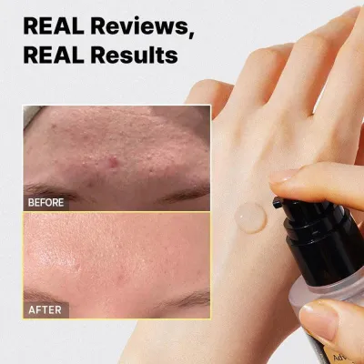 COSRX Advanced Snail 96 Mucin Power Essence – esencja regenerująca ze śluzu ślimaka – 100ml COSRX Advanced Snail 96 Mucin Power Essence – esencja regenerująca ze śluzu ślimaka – 100ml