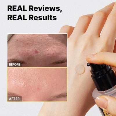 COSRX Advanced Snail 96 Mucin Power Essence – esencja regenerująca z 96% śluzu ślimaka COSRX Advanced Snail 96 Mucin Power Essence – esencja regenerująca z 96% śluzu ślimaka